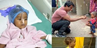 Sonu Sood helps a child get to normal life