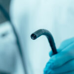 Hyderabad study highlights environmental impact of endoscopy procedures Hyderabad study highlights environmental impact of endoscopy procedures